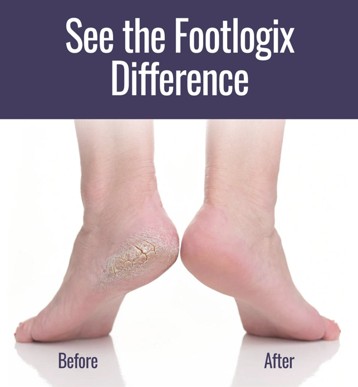 Footlogix Ultimate At Home Combo