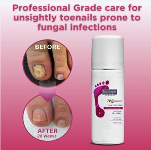 Footlogix Nail Tincture
