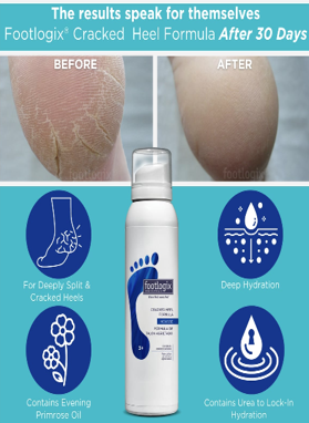Footlogix Cracked Heel